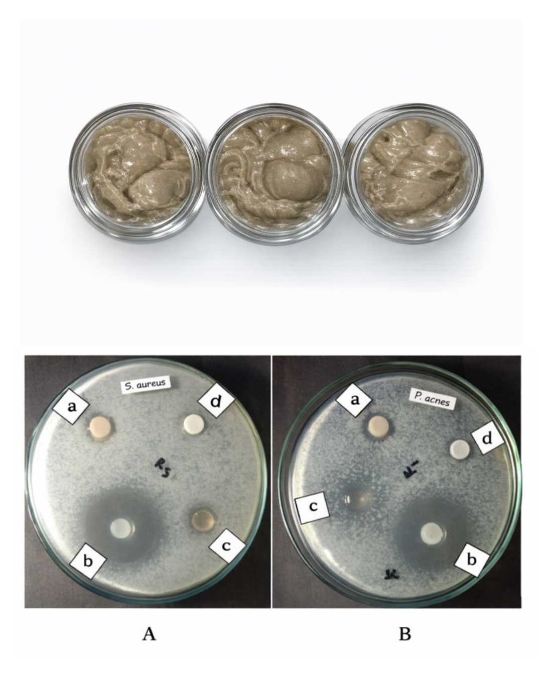 Formulation and Antibacterial Evaluation of Ethanolic Garlic Peel Emulgel Against Staphylococcus aureus and Propionibacterium acnes