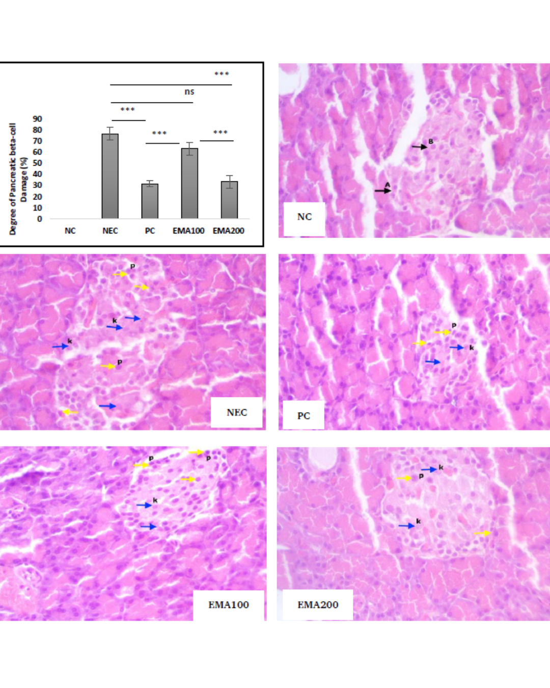Therapeutic Effects of Morus alba Leaf Extract on Fasting Blood Glucose and Pancreatic β-Cell Restoration in HFD–STZ-Induced Diabetic Rats